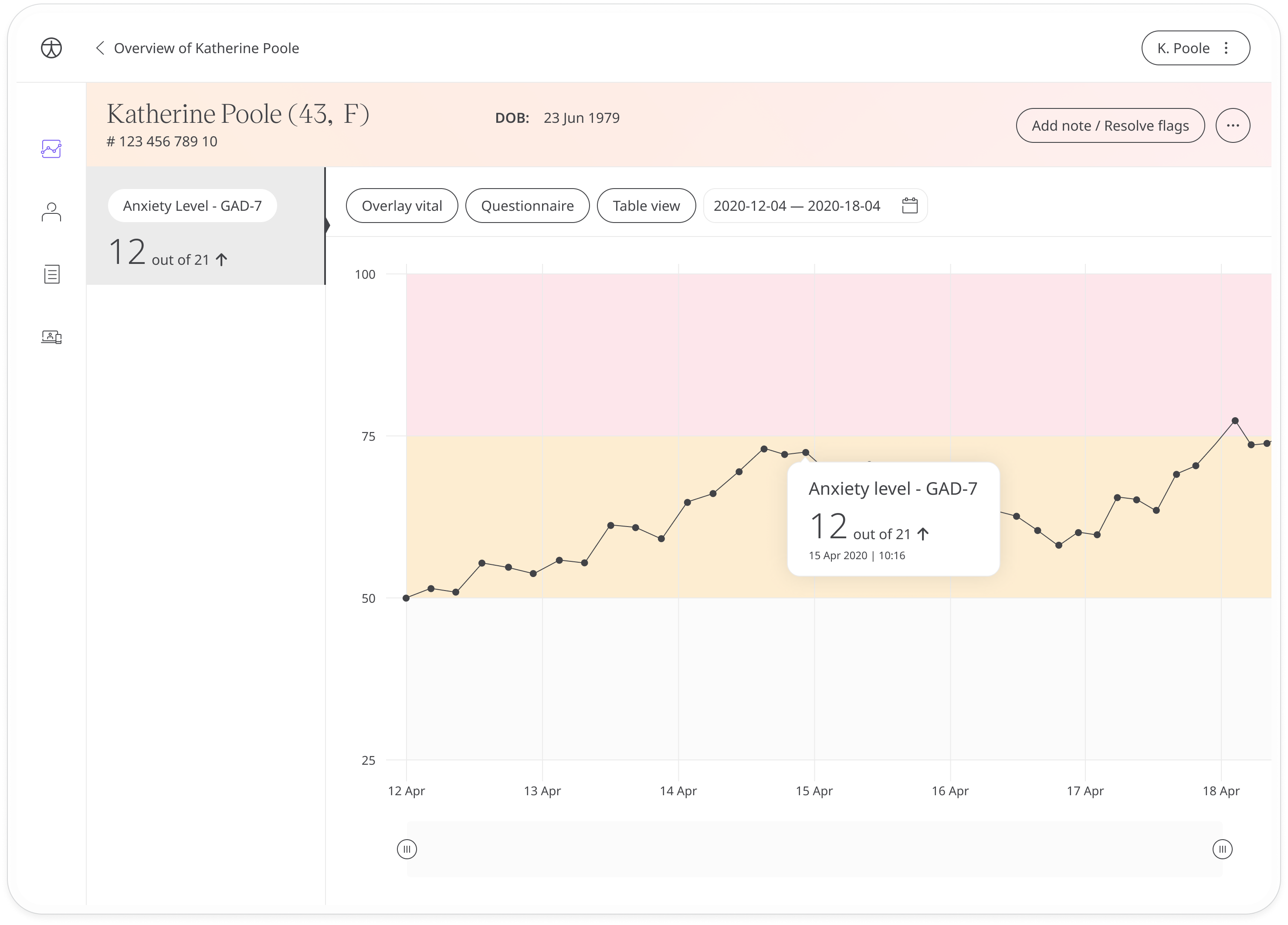 Chart view