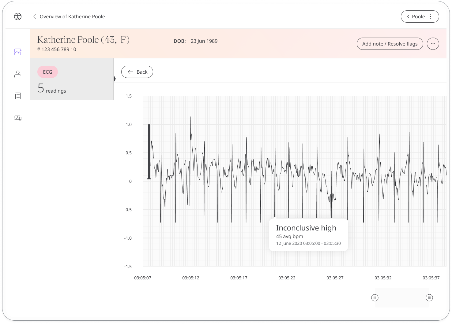 View ECG Monitoring - AliveCor from the Patient List