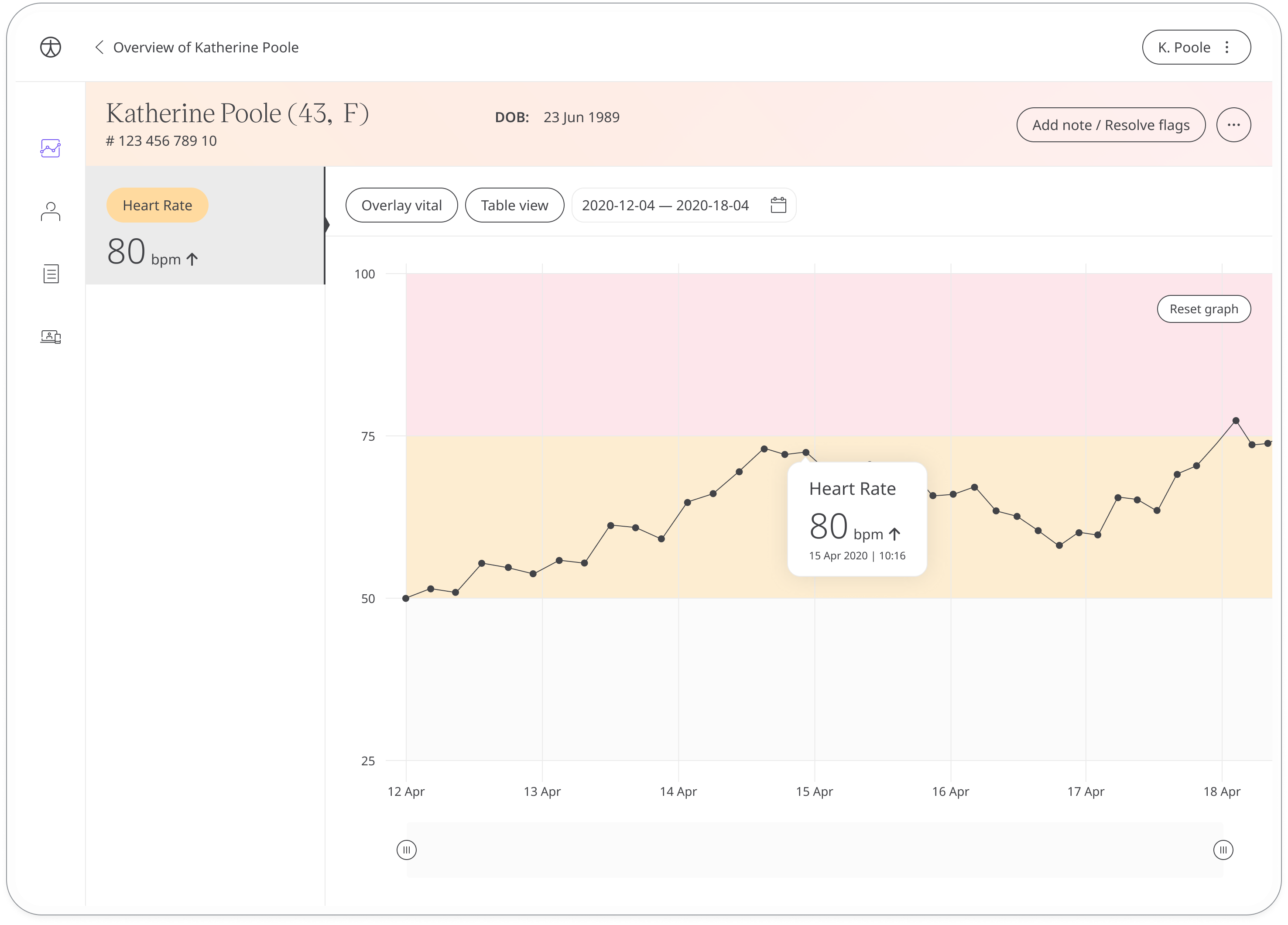 View patient heart rate in the Huma Portal